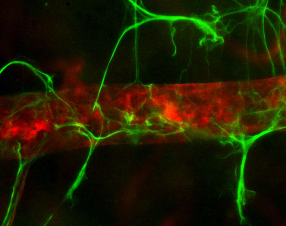 Retina - Jessica Teeling